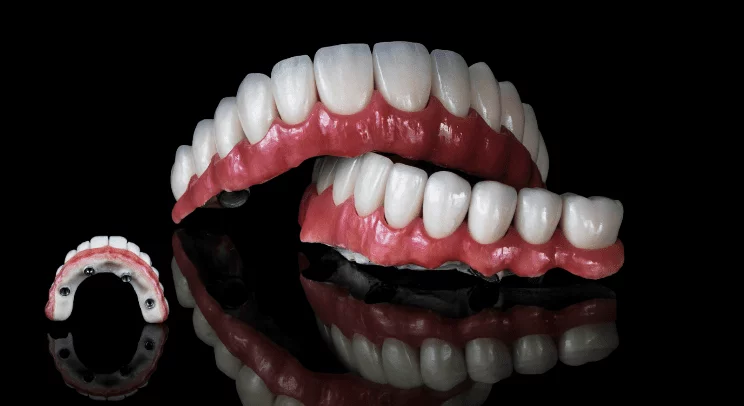 Sa kushton një implant dentar në Shqipëri? Zbuloni faktorët që ndikojnë në çmim, opsionet e trajtimit dhe pse Tarja Dental Clinic është zgjedhja ideale