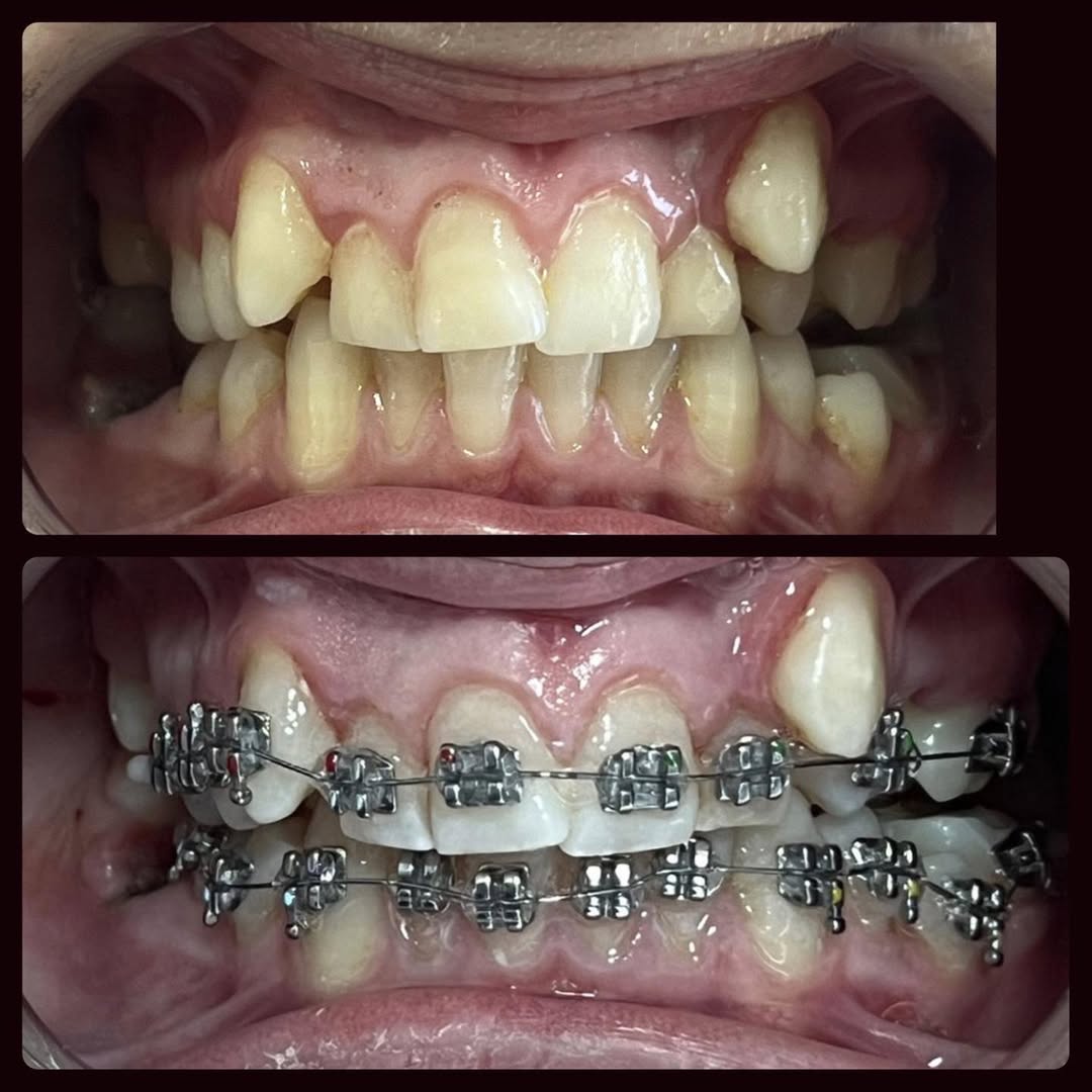 Orthodontic specialists at Tarja Dental Clinic in Albania