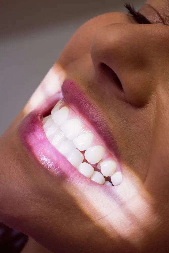 Traitement d’éclaircissement des dents pour un sourire plus lumineux